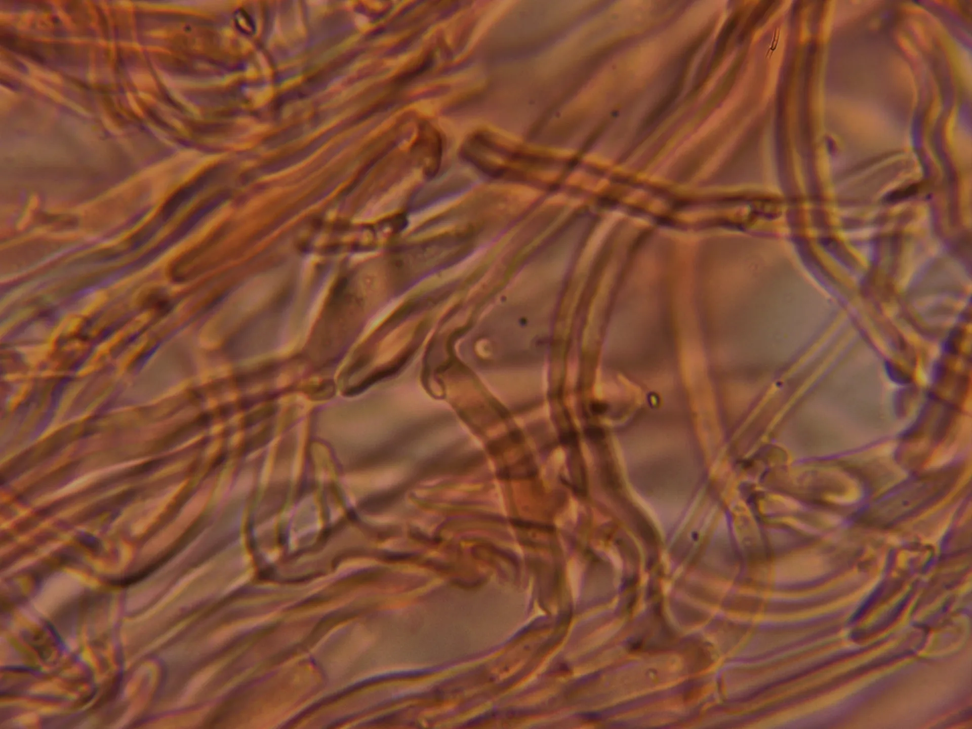 Microscopía de Panellus mitis - 10 - Pileipellis